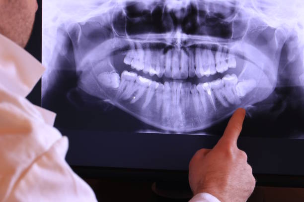 Best Emergency Tooth Extraction in Waynesboro, GA
